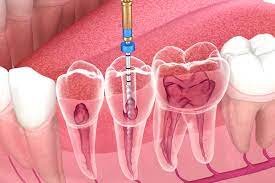 Dr. Sara Ali, Endodontist