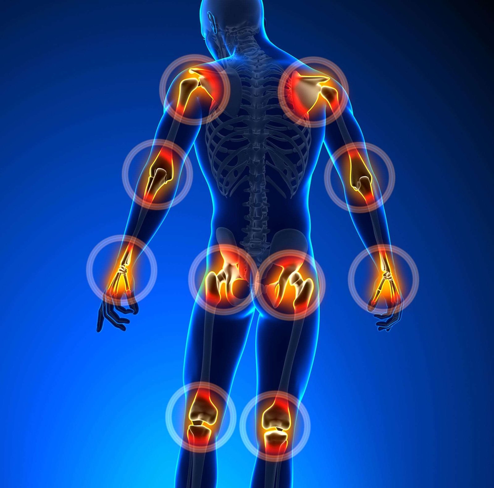 Joints Treatment Area