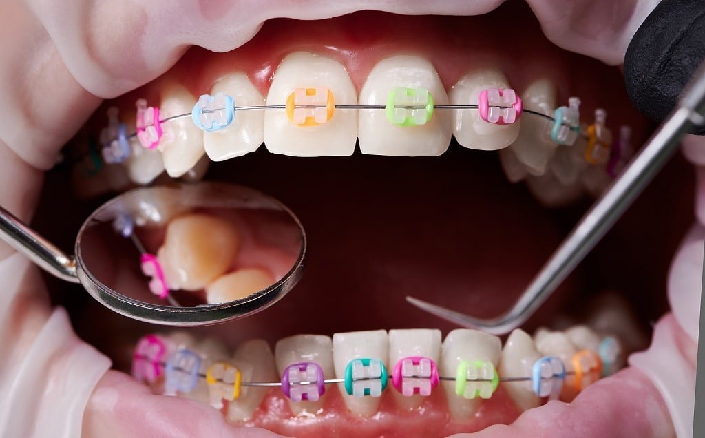 Dr. Fatima Khan, Orthodontist